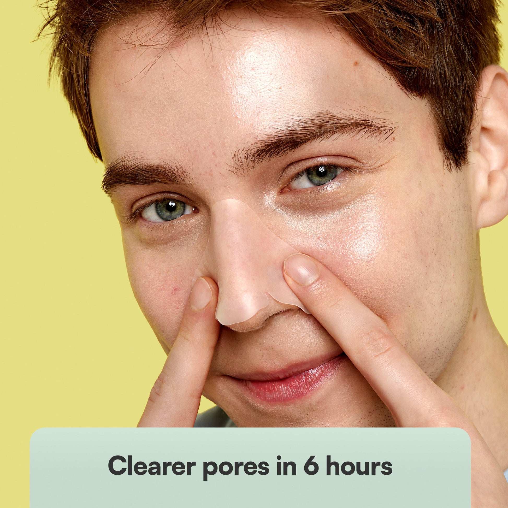 Nose Pore Patches - Skin Choice